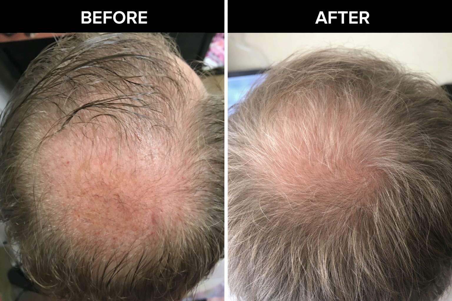 Scalp care gallery image