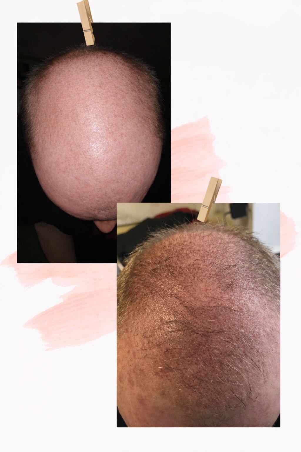 Hair and scalp treatment image
