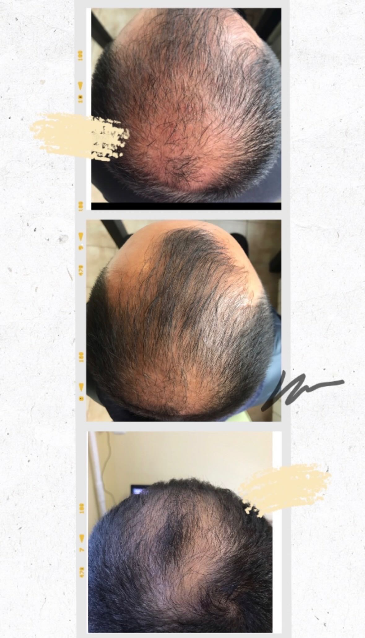 Hair and scalp results gallery image